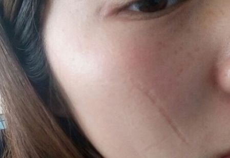 濟南哪家醫(yī)院做豐胸效果好？排名靠前，技術(shù)專業(yè)的有哪些？