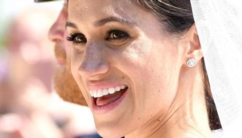 2023鄭州玻尿酸打唇紋前十位醫(yī)生強榜(李士成、魏星、于永梅醫(yī)生信任度很高！)