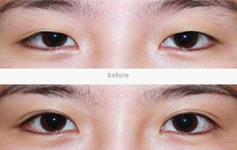 東莞哪家醫(yī)院的祛斑效果最好？一文揭秘東莞祛斑好醫(yī)院及其獨特療法