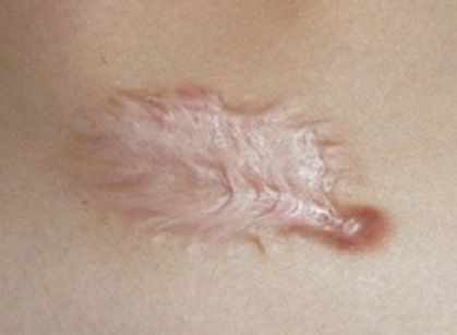 海南去雀斑哪家醫(yī)院好？探尋海南最受歡迎的雀斑祛除醫(yī)療機(jī)構(gòu)