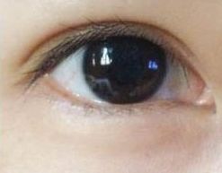 蘇州哪家祛痘醫(yī)院好？專家推薦的治療痘痘效果好的醫(yī)院