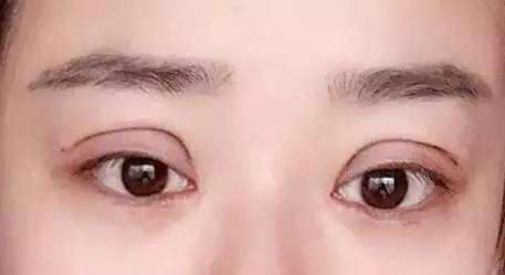 2023重慶男性面部除皺正規(guī)專家排行10強(qiáng)(馬曉琳、楊麗萍、張梅口碑實(shí)力在線！)