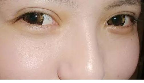 廣州法國ES膨體隆胸醫(yī)院排行榜前十