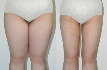 南京雀斑祛除十強(qiáng)診所：專業(yè)技術(shù)，效果顯著