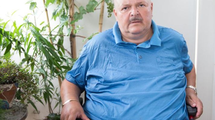 肥胖的危害和是否易患三高你了解多少