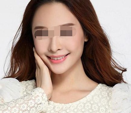 打玻尿酸后可能產(chǎn)生僵硬感？使用玻尿酸有哪些風(fēng)險(xiǎn)？