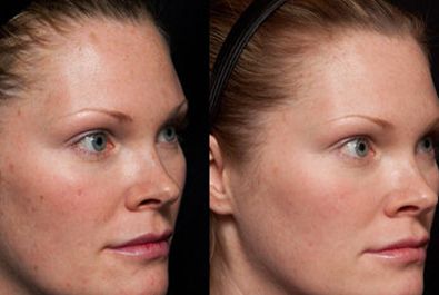 河北醫(yī)大牙科門診價(jià)格查詢，口腔種植牙費(fèi)用多少？