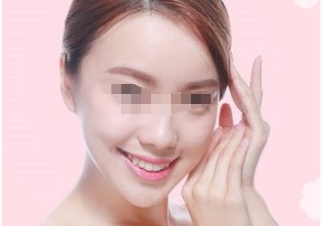 隆鼻手術(shù)失敗后的修復(fù)方式及風(fēng)險解析