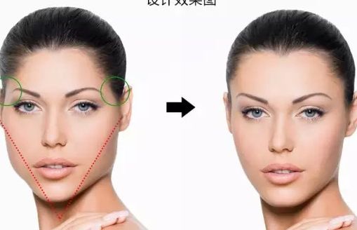 瘦身美容，腹部吸脂手術(shù)可顯著減掉多少腰圍呢？