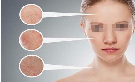 面部填充整形須知曉的注意事項(xiàng)