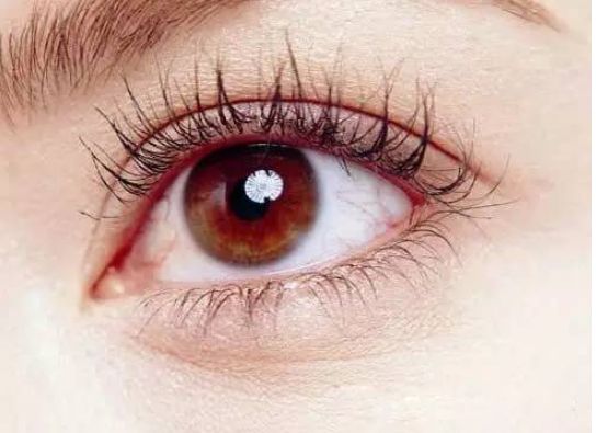 歐洲之星4D與光子嫩膚對(duì)比，助你理解抗衰和祛痘效果差異