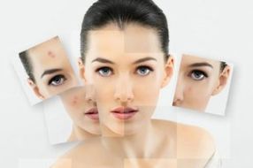 拉皮手術(shù)費(fèi)用及價(jià)格參考