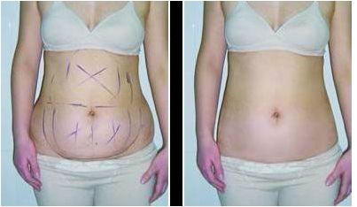 如何鍛煉臀部，打造完美曲線