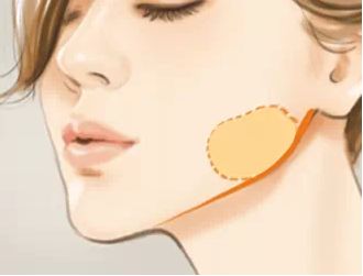 彩光嫩膚：有效去除紅血絲的好方法！