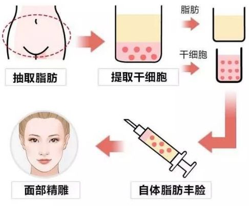 有效美白祛斑方法匯總，專業(yè)醫(yī)美與低成本自制全覆蓋！
