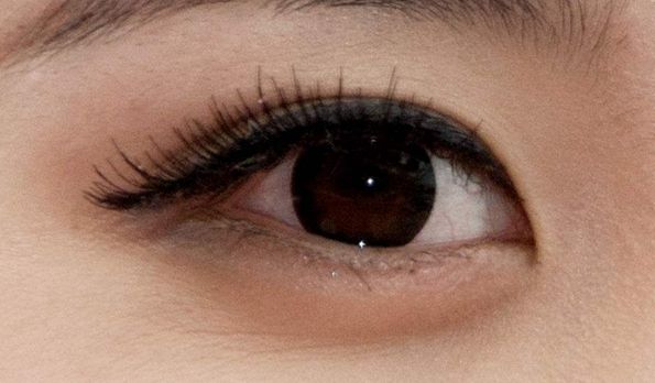 耳軟骨墊鼻尖手術(shù)有哪些優(yōu)勢及價格分析