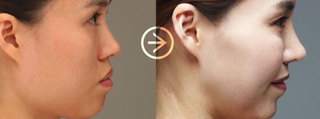 揭秘：讓你的臉型保持完美輪廓的關(guān)鍵！