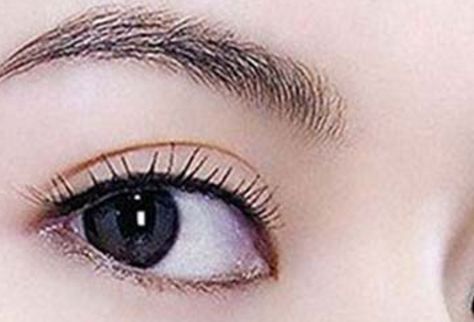 深圳金麗雙眼皮修復(fù)失敗的常見(jiàn)問(wèn)題及解決方案