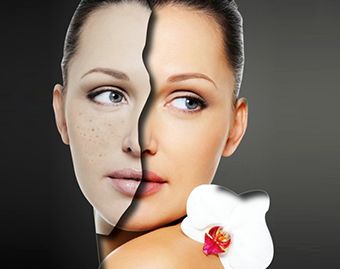 武漢哪家醫(yī)院做透明質(zhì)酸隆鼻效果好