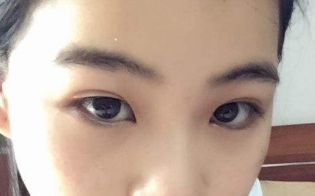 烤瓷牙的優(yōu)勢與劣勢，如何選擇？