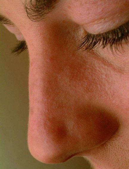 面部整形改變了許多人的生活態(tài)度，你知道哪些整形手術(shù)適合男性呢？