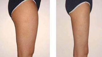 如何有效預(yù)防眼角皺紋，給你的眼部肌膚帶來長(zhǎng)久的保護(hù)