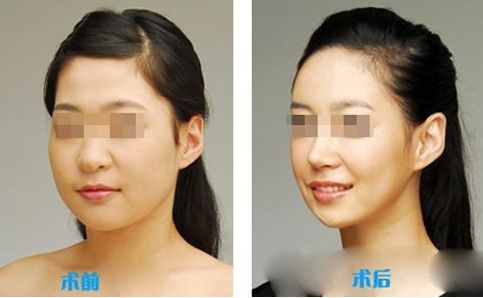 鼻子大小與顏值相關(guān)度到底如何？揭秘其中奧秘