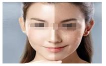 吃海鮮對(duì)于使用瘦腿針的人來(lái)說(shuō)是否適合？