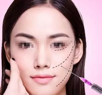 玻尿酸鼻子整形維持時長與價格及優(yōu)勢一覽