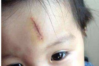 成都哪里做拉皮手術(shù)效果好，八大處、晶膚、嬌點(diǎn)等5家備受推薦