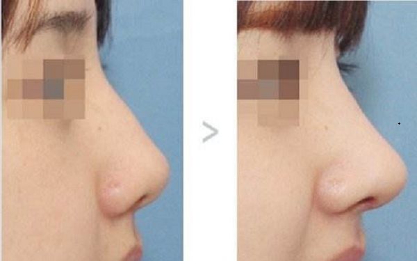 頭皮水光補養(yǎng)秘籍，助你恢復健康頭皮！