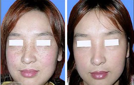 打造迷人眼神，輕松引愛火