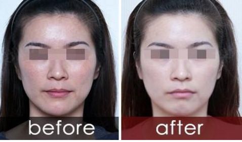 義烏美寶萊洗牙價格查詢