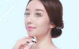 雙眼皮修復(fù)，選對(duì)時(shí)機(jī)，展現(xiàn)美麗眼眸