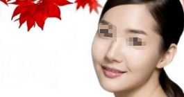 下巴整形手術(shù)有哪些方法？下頜角整形是否安全？