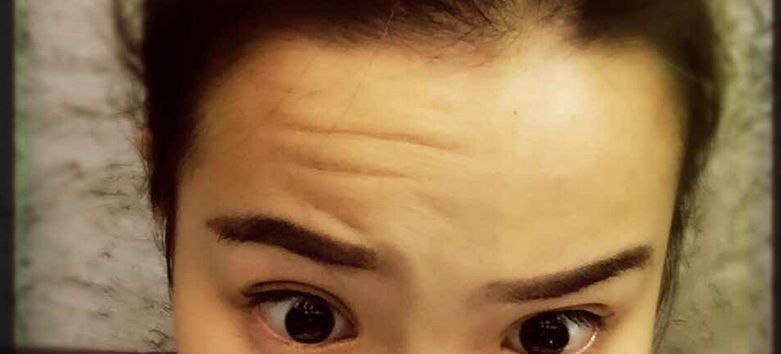 超聲波去眼袋：效果持久還是短暫？