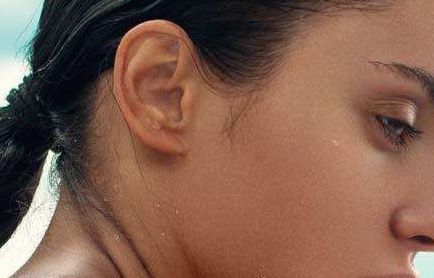 隆鼻手術(shù)的效果：修復前后明顯變化！