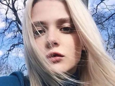 下頜角整形后皮膚松弛有哪些解決辦法？