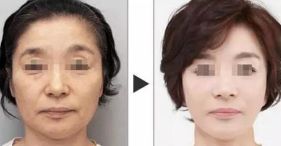 如何使陰道恢復(fù)緊致的方法