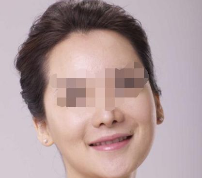 腹部吸脂的獨特優(yōu)勢及特點你知多少