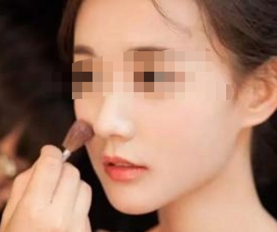 女子臀部整形好風(fēng)險(xiǎn)！整形手術(shù)遭不法醫(yī)生用水泥灌注