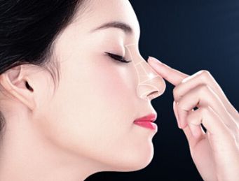 隆鼻手術(shù)的效果和感受有哪些