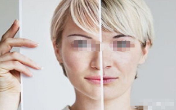 割雙眼皮紋理調(diào)整技巧可改善眼部線條？