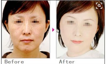 獨(dú)家分享！塌鼻子的完美發(fā)型指南，為你打造精致生活