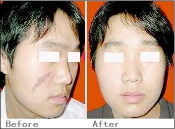 北京鉆石之星醫(yī)療美容真正靠譜嗎？價格公道嗎？全面價格表供您參考！