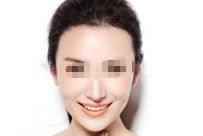 水光注射：祛斑美膚的好幫手