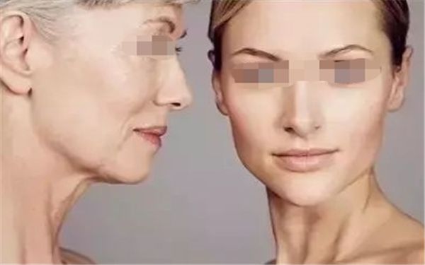 法思麗玻尿酸和黑金哪個更適合我？