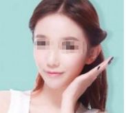 孫儷的容顏變化引發(fā)熱議，她真的進行了整容嗎？