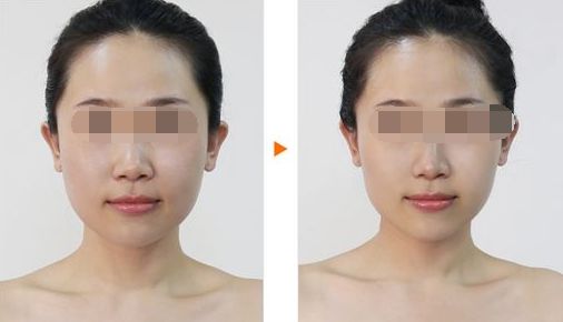 提升容貌魅力，輕松讓五官變立體