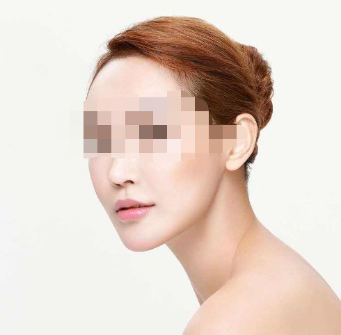 處女膜修復手術(shù)成功率及手術(shù)過程詳解